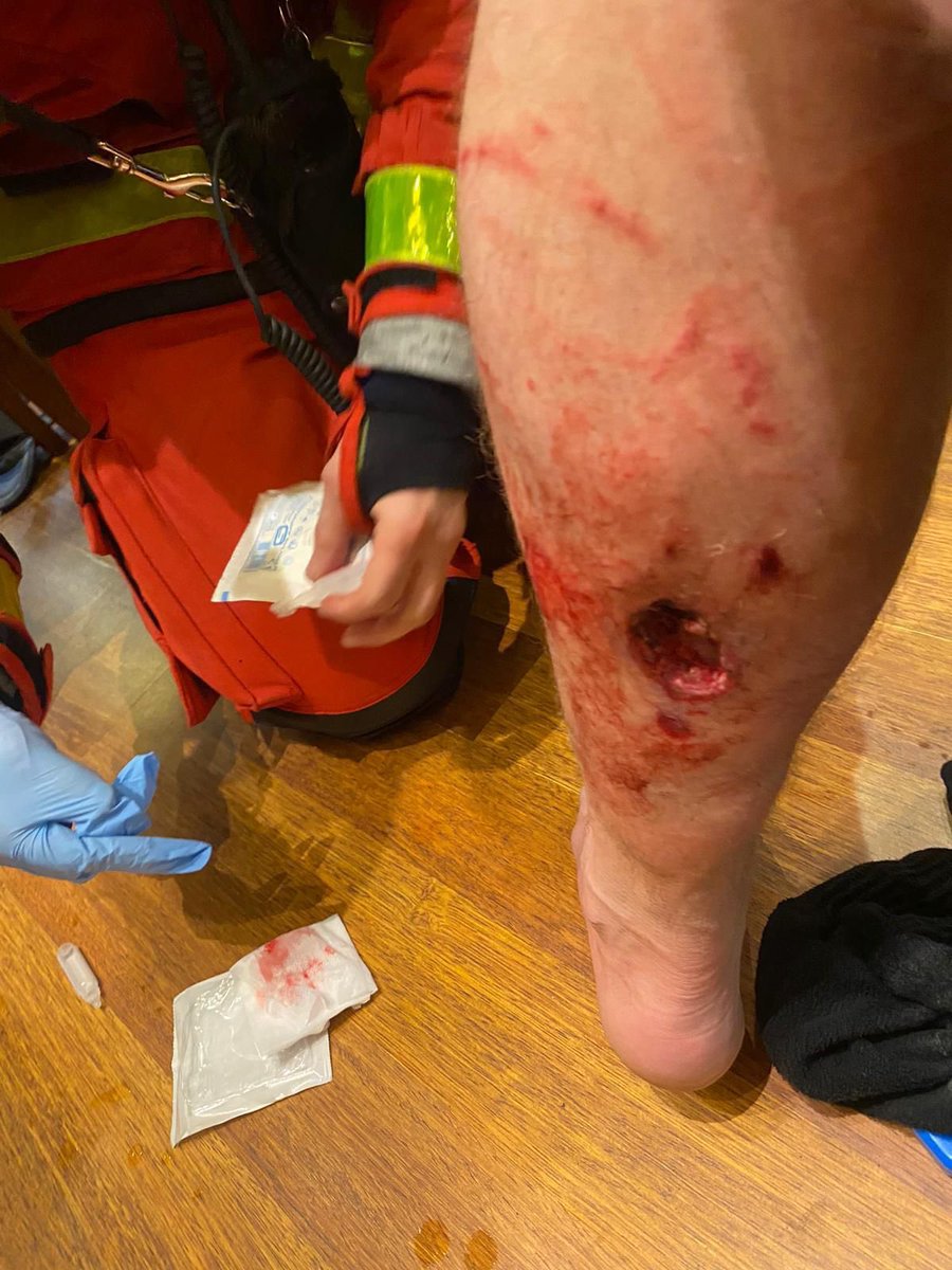 LindaKebbab's tweet photo. Pendant que certains dont des députés se plaignent de la réponse des policiers/ gendarmes hier, que d’autres trouvent les équipements de protection disproportionnés, voici la jambe (malgré la jambière) d’un gendarme après l’explosion d’une bombe agricole. Une BOMBE. @LDH_Fr ? https://t.co/P37d6k0To6