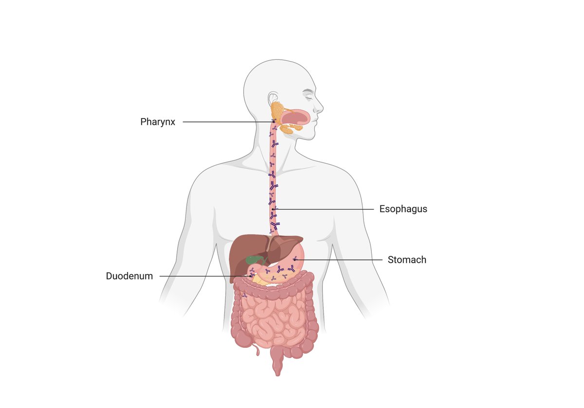 IgG4 is associated with eosinophilic esophagitis (EoE), but its role in pathogenesis is unclear. We found that food-specific IgG4 levels are increased in the throat, stomach, and duodenum in addition to the esophagus in patients with EoE. bit.ly/41qy8bl #SpringerNature