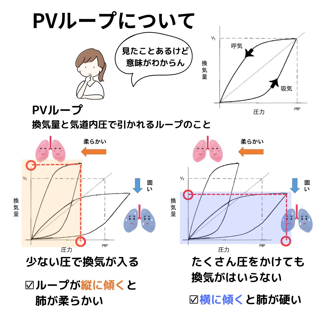 cetenshoku's tweet photo. 本日は【人工呼吸器について】です。
PVループについてめちゃくちゃ簡単に解説してます。
・PVループってなに？
・見たことあるけどわからん
という人は是非見てください。
勉強会の資料などにも役立てていただけたらと思います。
参考になったらいいね・リツイートお願いします。
＃臨床工学技士 https://t.co/He50UEjVB5
