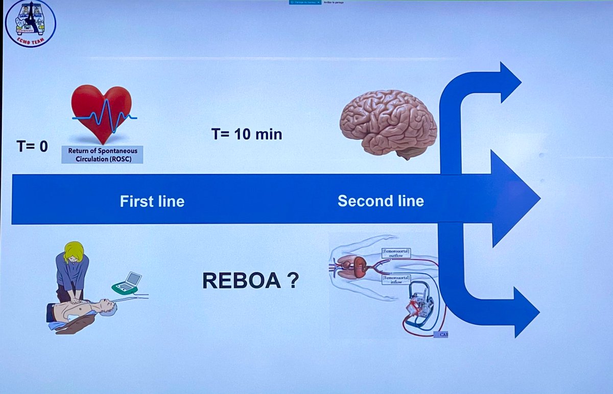 🫀 #REBOA in OHCA? In zone 1 may ⬆️ brain/cardiac perfusion, occluding aorta
🎈1st line to ⬆️ P vs epinephrine?
🎈between 1st/2nd line to extend window allowing to tranfer pt to #ECMO center?
training/in-vivo research pivotal
<a href="/LionelLamhaut/">Lamhaut</a> #ParisRescue
📖 rdcu.be/cWapC