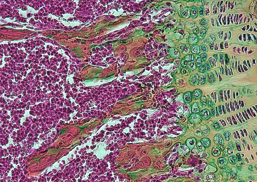 🚨Open Prof &amp; Associate Prof positions in 💪🦴#musculoskeletal biology &amp; Regenerative Medicine <a href="/nyulangoneortho/">NYU Langone Orthopedics</a> 🚨 🦴<a href="/AcademicJobs/">AcademicJobs</a> <a href="/nyugrossman/">NYU Grossman School of Medicine</a>   Please RT! nature.com/naturecareers/… #stemcells #devbio #orthotwitter #bone #muscle