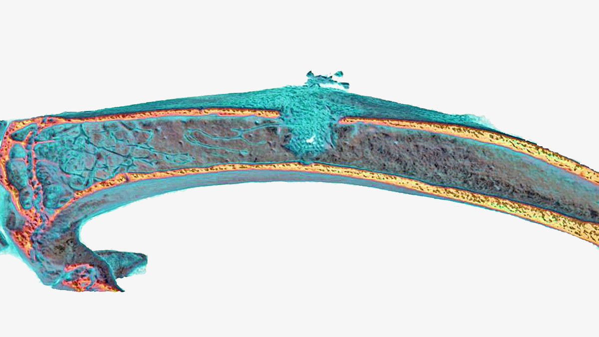🚨Post-doc position available in our lab!Leucht lab
<a href="/nyugrossman/">NYU Grossman School of Medicine</a> 🚨 Exciting chance to study human bone🦴 aging &amp; disease as part of our close-knit &amp; supportive team #orthotwitter <a href="/NYC_Postdoc/">NYC Postdoc Coalition</a> #stemcell #devbio <a href="/AcademicJobs/">Academic Jobs</a> Please RT! nature.com/naturecareers/……
<a href="/PhilippLeuchtMD/">Philipp Leucht, MD</a>