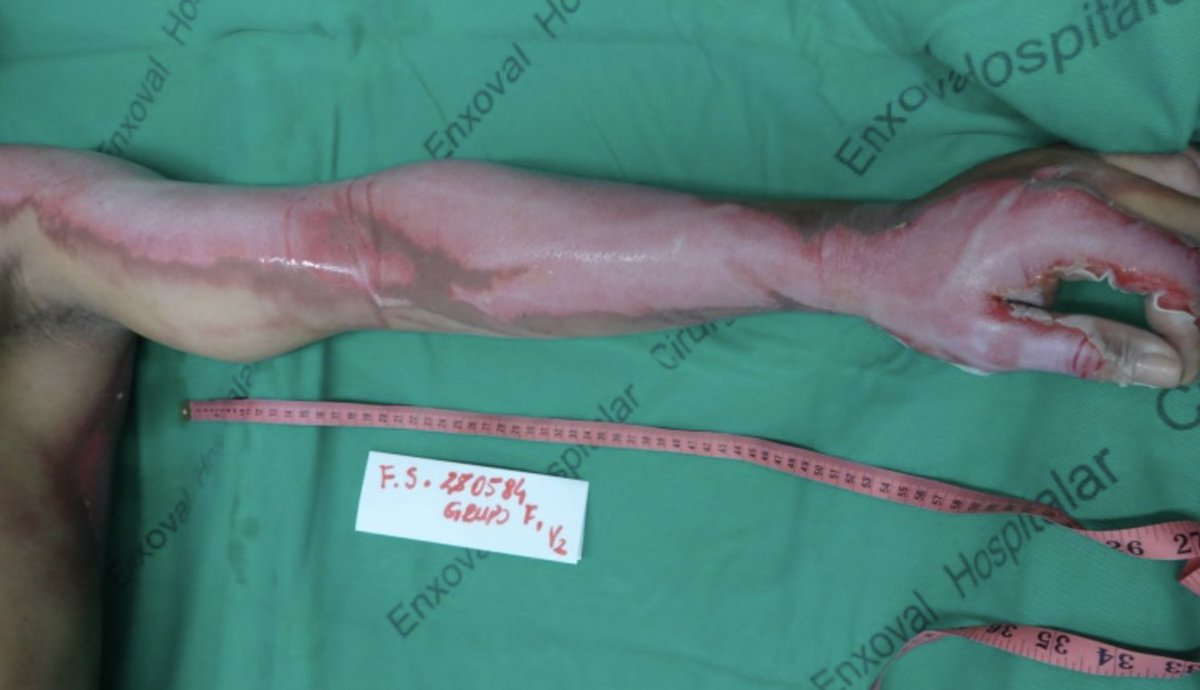 Mark_Sisson tweet media