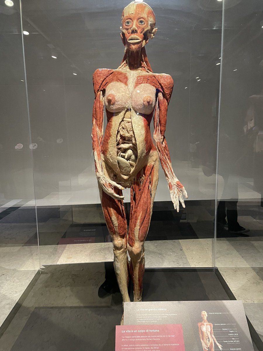 KatiaCarboni4's tweet photo. “Il vostro corpo è l'arpa dell'anima,
e sta a voi trarne
dolce musica
oppure suoni confusi”. Khalil Gibran (1883-1931)!
La perfezione del corpo umano riesce sempre a lasciarmi senza parole #bodyworlds #milano #milan #bodyworld https://t.co/b4dcPAVsWH