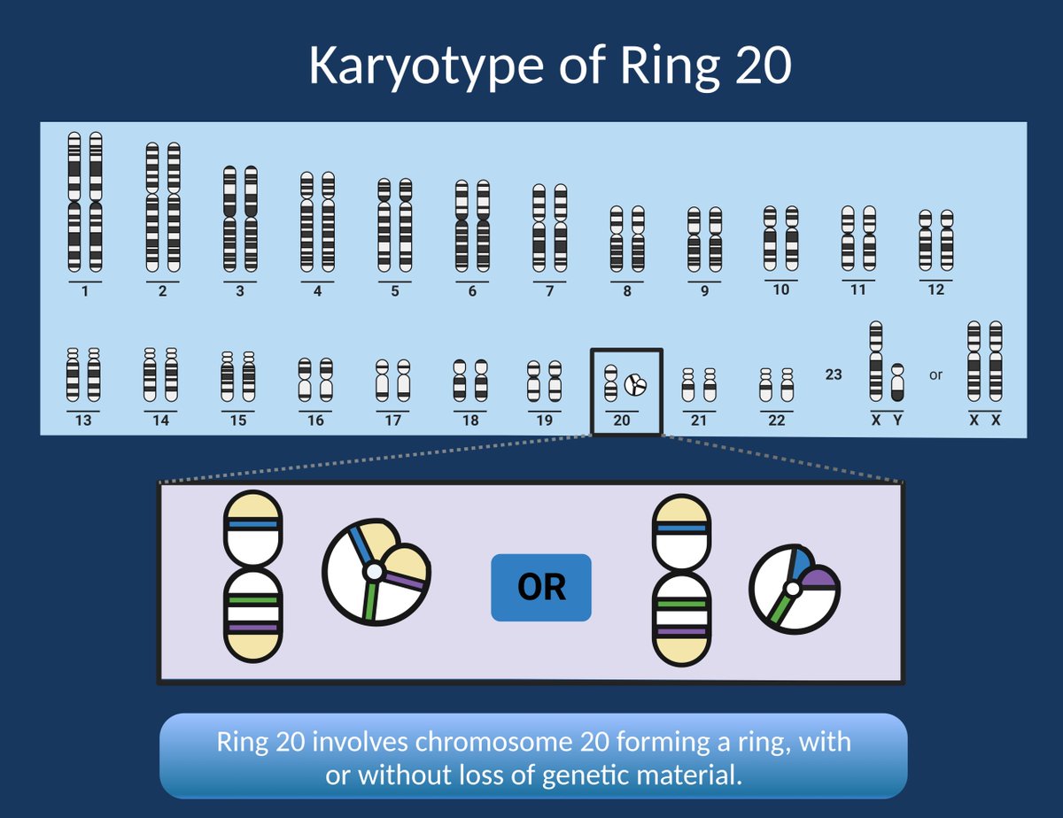 IngoHelbig's tweet photo. ...here is Stacey's blog post on Ring 20

...one of the rare causes of genetic epilepsies that we frequently don't think about. 

@Ring20UK https://t.co/LdEBYbJxdq