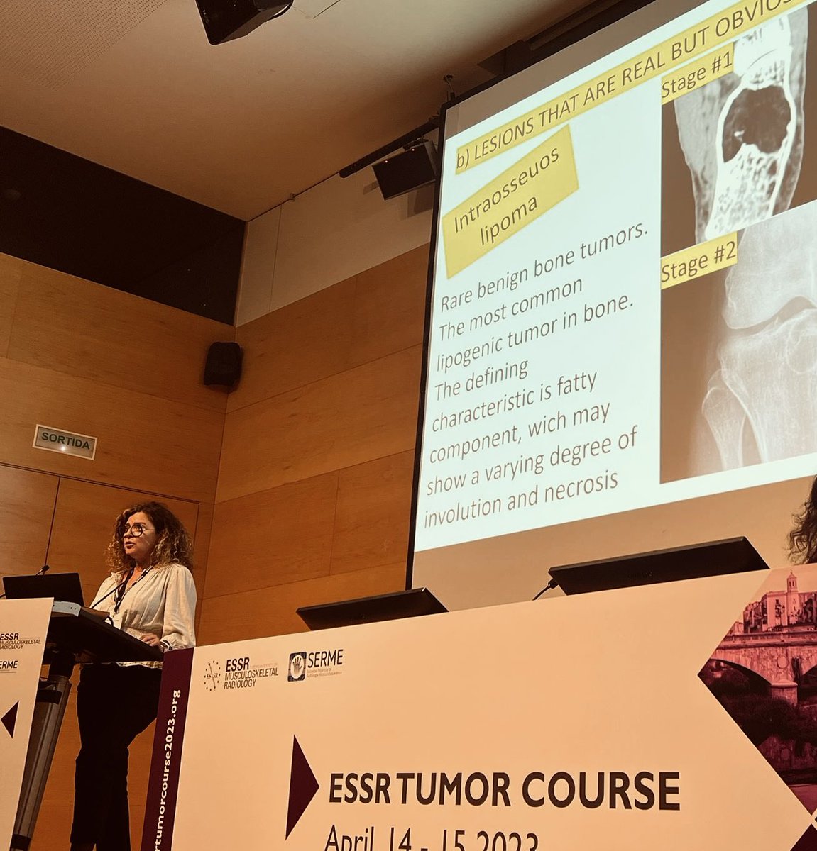 Honored to speak at #essrtumorcourse2023 Some bits of my talk “don’t touch lesions” @ESSRMSK @SERME