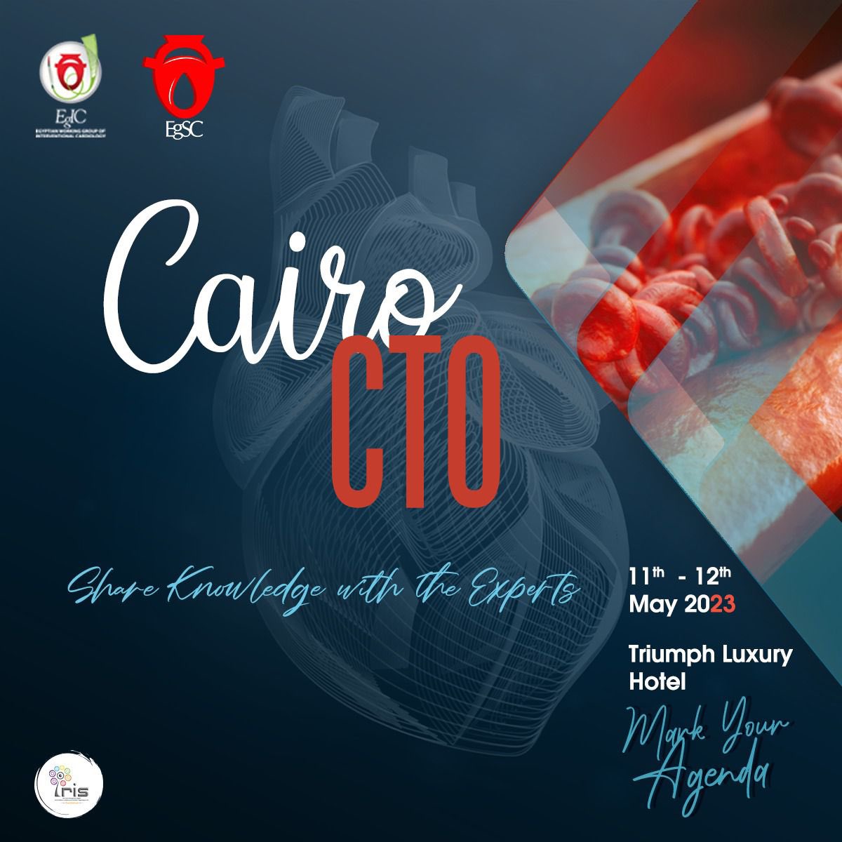 Be ready for the big event Cairo CTO 
You will be surprised don’t miss this event 
Live cases ,live in a box cases and focus sessions
