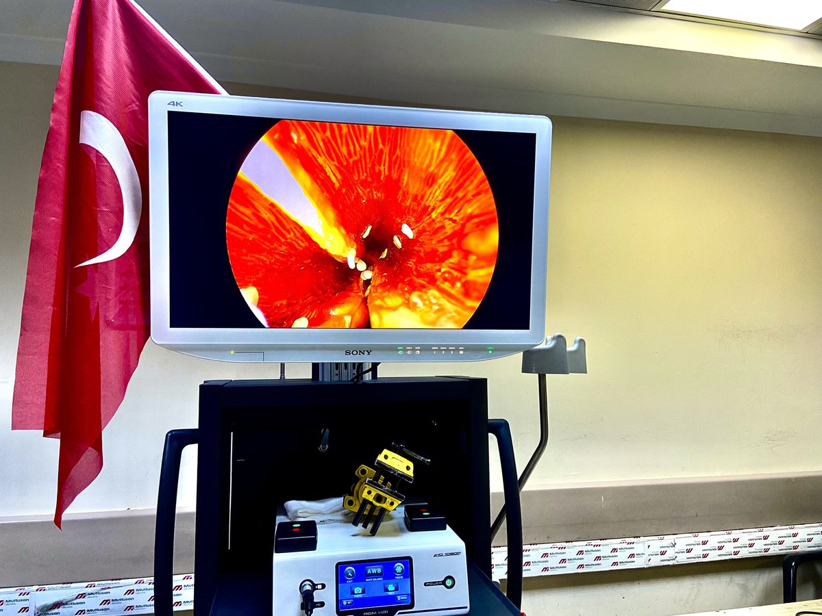 Kapalı ameliyat olarak bilinen laparoskopinin görüntüleme sistemi olan Endovizyon Sistemlerini ülkemizde ilk kez UZMED firması üretmeyi başardı.

UZMED, yerli ve milli olarak ürettiği bu ürünün yüksek teknoloji ürün belgesini , faydalı model patent ve CE belgesini de almıştır.