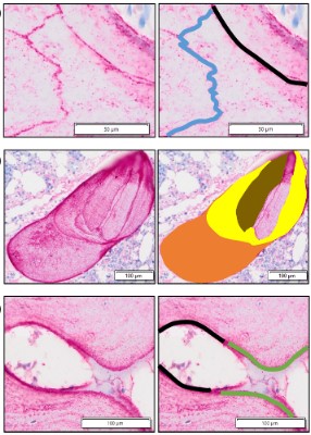 Data from a new #JBMR study suggest that ixazomib induces overflow remodeling-based bone formation by decreasing the level of bone resorption and promoting longer bone formation events #ASBMR <a href="/MartaDazdelCast/">Marta Díaz del Castillo</a> <a href="/TvedenMichael/">Michael Tveden Gundesen</a> <a href="/LevinGeiser/">Thomas Levin Geiser Andersen</a> 

ow.ly/ZYa850NI76E