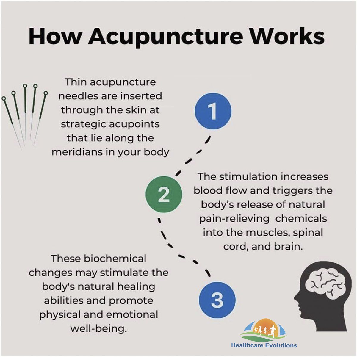 By The Way What Is Acupuncture?

#acupuncture #medicalacupuncture #health #healthylifestyle #healthcare #healthyliving #tips #care #australia #newcastle