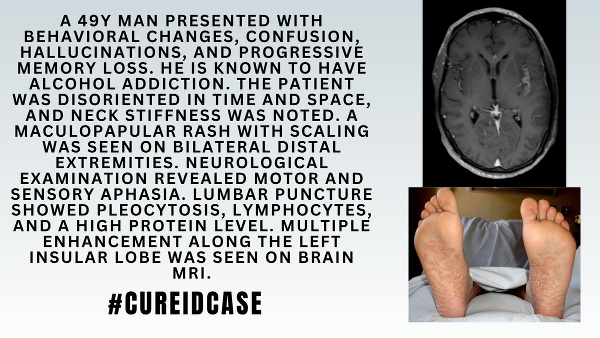 id_cure's tweet photo. #CUREIDCase
Find more details on CURE ID that will help you make the correct diagnosis: https://t.co/5aZC0bEHZs
See the 🧵for the poll!
#IDTwitter #IDMedEd #MedEd #IDCase #CUREID https://t.co/dOOOTSZamN