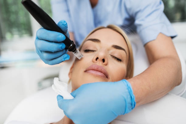 SKINPEN MICRONEEDLING ✨

SkinPen’s Precision can enhance your complexion, reduce neck wrinkles, and fade acne scars in just THREE sessions!

Call us TODAY to book your free consultation!
.
.
. 
#medispa #botox #beauty #antiaging #aesthetics #fillers #medicalspa