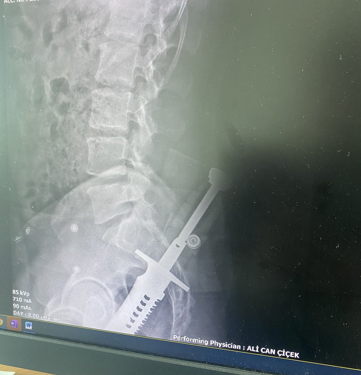 Dün polikliniğimde darp edilip ölümle tehdit edildim. Ama şahıs hala serbest. Bugünde polikliniğime hasta kasatura ile girdi. Neden? Lazım olabilirmiş. Bişeylerin düzelmesi için birinin ölmesi mi lazım. Kime güveneceğiz? Kim bizi koruyacak? <a href="/saglikbakanligi/">T.C. Sağlık Bakanlığı</a> <a href="/drfahrettinkoca/">Dr. Fahrettin Koca</a>