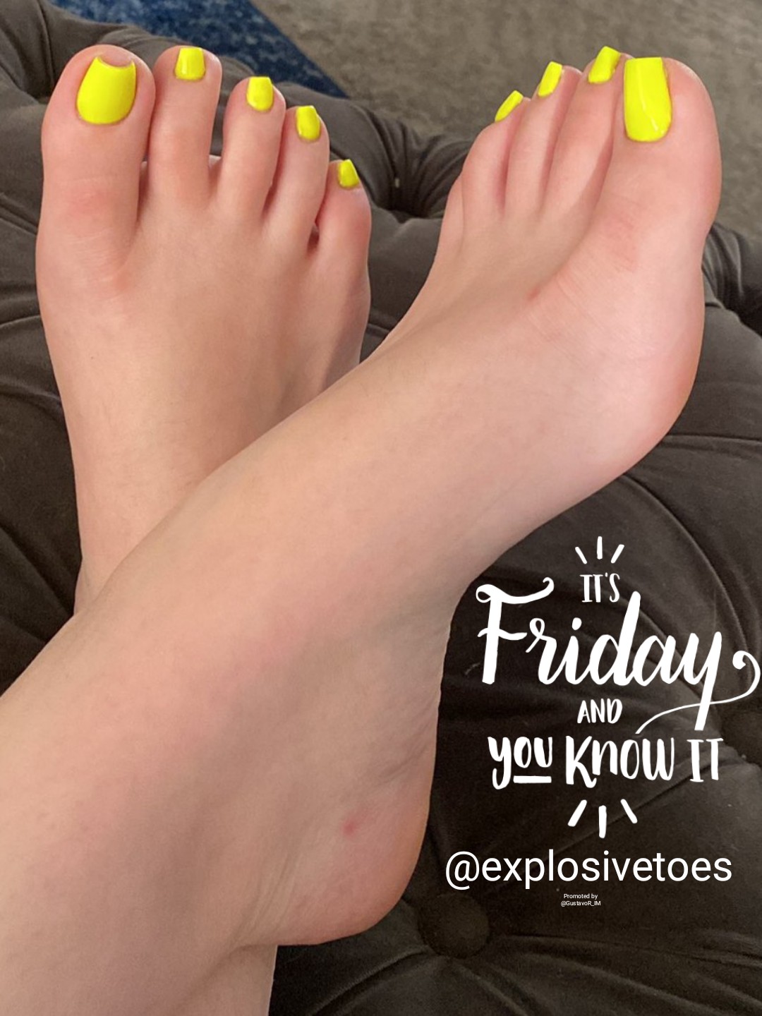Gustavo on X: @explosivetoes So attractives yellow #toenails and a lovely  #sexy #toes 💗💝👍💯💦💦💦 t.cohpf9M1OK80  X