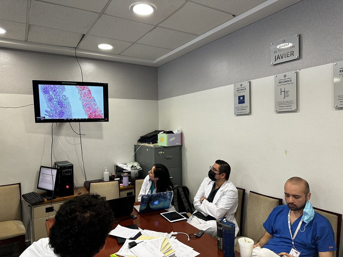 Nephro_Ivan's tweet image. Sesión de nefropatología con residentes de nefrología de @nefrologia_HJM del @HospitalJuarezM y de @NefroHC de @HCentralSLP . Caso muy interesante de GNRP por Lupus Like por HIVICK. 
#Nephropath
 #KidneyDisease 
#kidneybiopsy