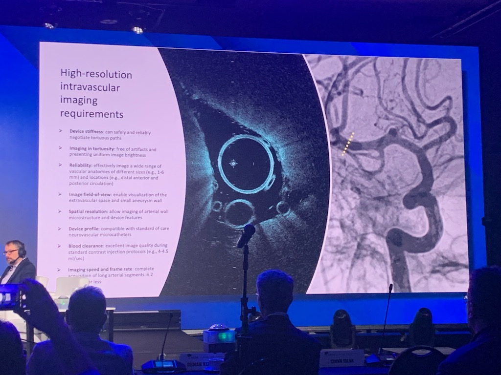 Cure4Stroke's tweet photo. It is a historic day in the Cerebrovascular world!

At @WLNCofficial, we presented the first in man cases of neuro HFOCT - and it surpassed all our expectations!!! https://t.co/95U8bYhzXi