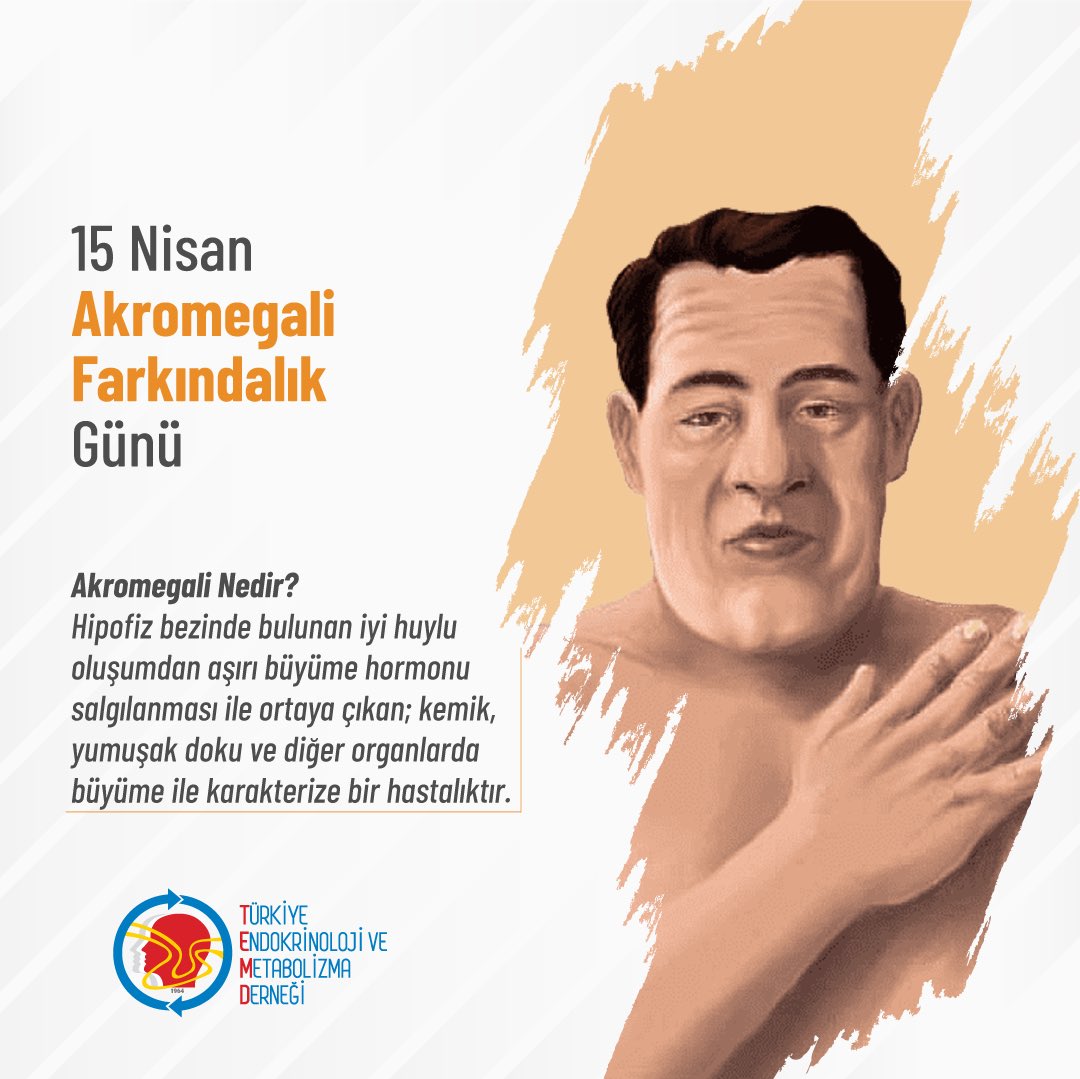 temdorgtr's tweet photo. 15 Nisan Akromegali Farkındalık Günü.

#Akromegali #temd #endokrinoloji #endokrin #endokrinolojivemetabolizma #endokrinolojivemetabolizmahastalıkları https://t.co/hpN4xGacag