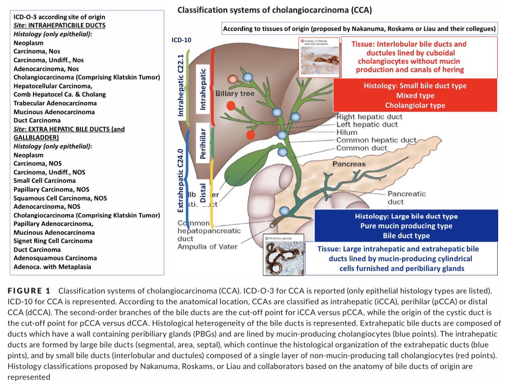 Classification systems of CCA

onlinelibrary.wiley.com/doi/pdfdirect/…