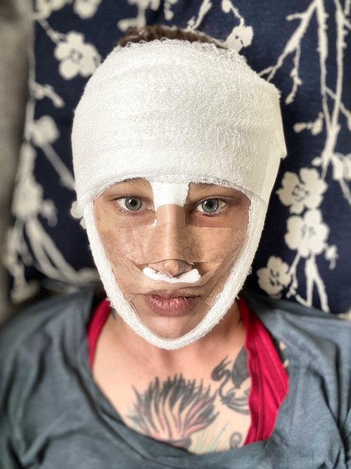 On my 2nd full day of recovery. Ty for all the kind words &amp; well wishes. Feeling the love!💜 https://t<a href="/tag/mvsales"class="tags"><span>#mvsales</span></a>