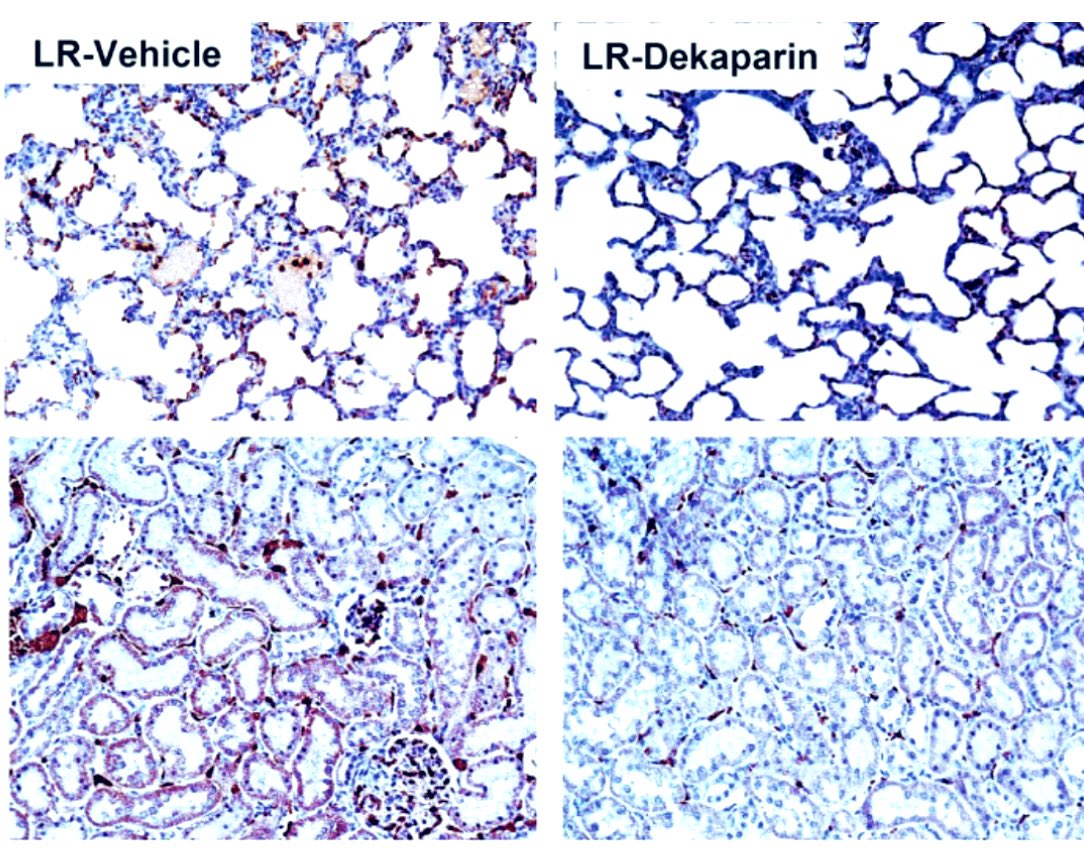 Jessica Cardenas (@jccardenas52) on Twitter photo Excited to share our paper is out online in <a href="/FrontImmunol/">Frontiers - Immunology</a> on 3-O-sulfated heparan sulfate for shock-induced thromboinflammation!
frontiersin.org/articles/10.33… Excited to share our paper is out online in <a href="/FrontImmunol/">Frontiers - Immunology</a> on 3-O-sulfated heparan sulfate for shock-induced thromboinflammation!
frontiersin.org/articles/10.33…