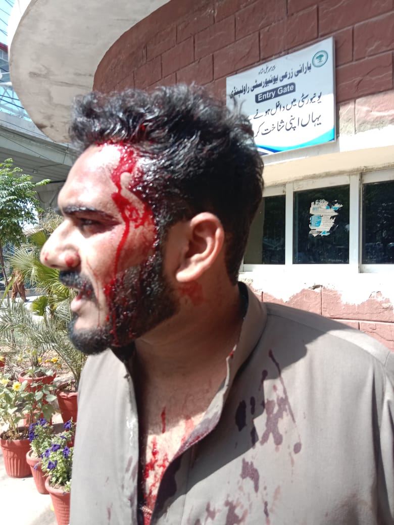 Ksaraikstan's tweet photo. We Strongly Condemned this brutual act!
University Administration is totally responsible for this.
Students just need Justice!
#saveArid
#DictatorDSA
#studentsNeedJustice
#saveculture
@DCRawalpindi
@hecpkofficial https://t.co/ArqXt6IT9C