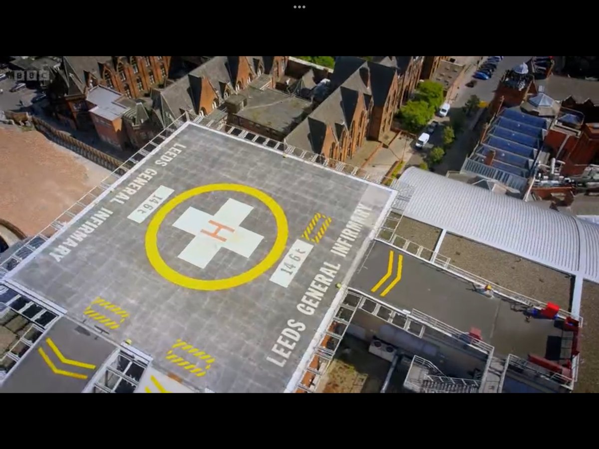 Watching Saving Lives In Leeds. The first episode is about a guy  who gets a hand transplant who lost his limbs a year ago. It’s so interesting and I definitely recommend it. Xx

<a href="/BBCOne/">BBC One</a> <a href="/BBCiPlayer/">BBC iPlayer</a> <a href="/LeedsHospitals/">Leeds Teaching Hospitals</a>