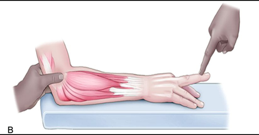 JOSPT's tweet photo. NEW #PerspectivesForPatients in the April @JOSPT
Our handy resource for sharing with patients with Lateral Elbow Pain can be located 👉 https://t.co/ZIdZi30eRd
AND if you're yet to read the full #PracticeGuideline head here 👉 https://t.co/3EFoKAb34s
#yourJOSPT https://t.co/aMbYJXiVzm