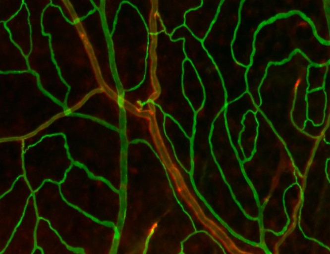 Science Immunology (@sciimmunology) on Twitter photo The influence of lymphatic vessels in the dura mater of the meninges on neuro-inflammatory diseases has been significantly overstated, new research from <a href="/helsinkiuni/">University of Helsinki</a> in mice asserts.
📄: scim.ag/2fv The influence of lymphatic vessels in the dura mater of the meninges on neuro-inflammatory diseases has been significantly overstated, new research from <a href="/helsinkiuni/">University of Helsinki</a> in mice asserts.
📄: scim.ag/2fv