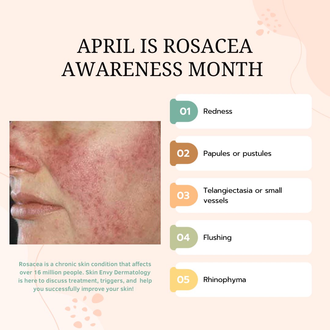 April is Rosacea Awareness! Skin Envy Dermatology is here to help you. If you have Rosacea or think you may have Rosacea call 402-936-6198 and we will help you to improve your skin!
