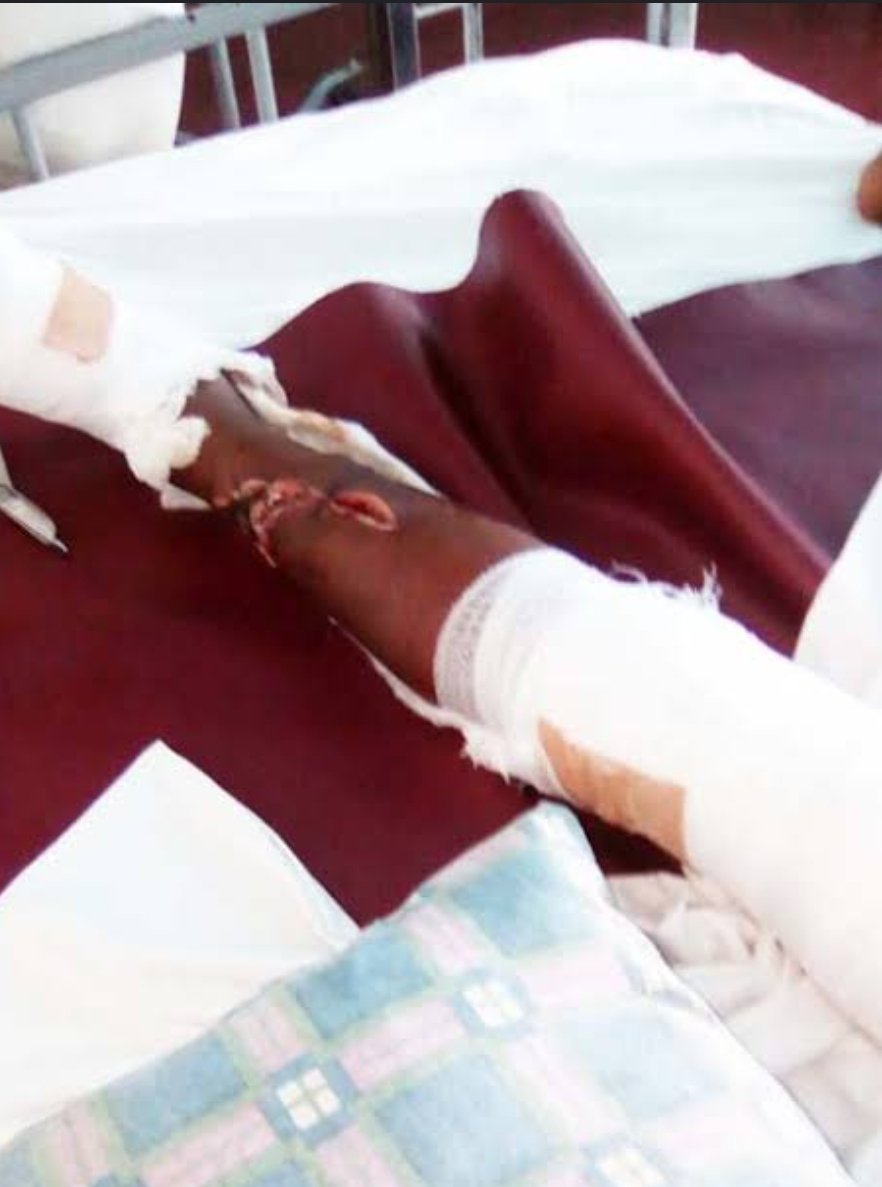 NannyRuth413751's tweet photo. @DONJAZZY @deejaybign @oxladeofficial @ayrastarr @DONJAZZY sir I really need your help, am a nanny at, brilliant kids daycare, I had an accident 3days ago, have not been able to get proper treatment, please @DONJAZZY support me, am dying of pains @MAVINRECORDS @DONJAZZY 
#BelieveMe #BelieveMe #BelieveMe @Johnnydrille ❤ https://t.co/weJ9Mv8h30