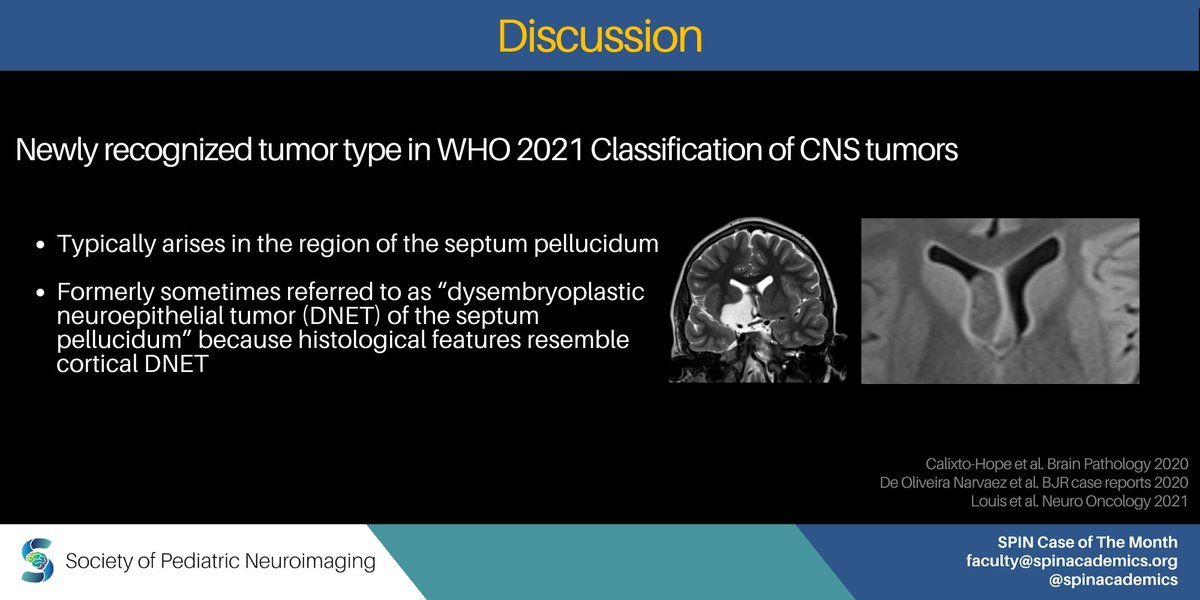 spinacademics's tweet photo. SPIN Monthly
Here’s our case for April. Learn about pediatric tumors.
https://t.co/e6iQQdCUS1 https://t.co/wlHdHHck8C