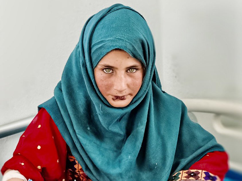 Maternité de Saydabad - Afghanistan - Mars 2023
Retrouvez « Kaboul : Année 0, » un documentaire exclusif co realisé avec  <a href="/LeSommierRgis/">Régis Le Sommier</a> juste ici ➡️ omertamedia.fr/movie/110/