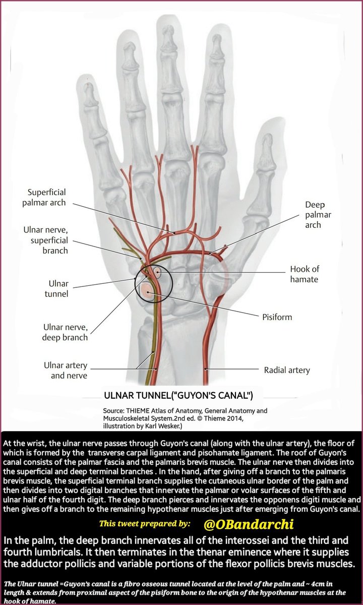 OBandarchi's tweet photo. 🛑Ulnar/Guyon's canal syndrome refers to compression of ulnar nerve within the ulnar canal. 
-Sensory:
Pain &amp;paraesthesia 1 1/2 digits

-Motor:
Weakness(W)of thumb adduction (adductor pollicis),
W of finger abduction&amp;adduction (interossei),
W of little finger flexion&amp; hypothenars https://t.co/C6XjinzTTX