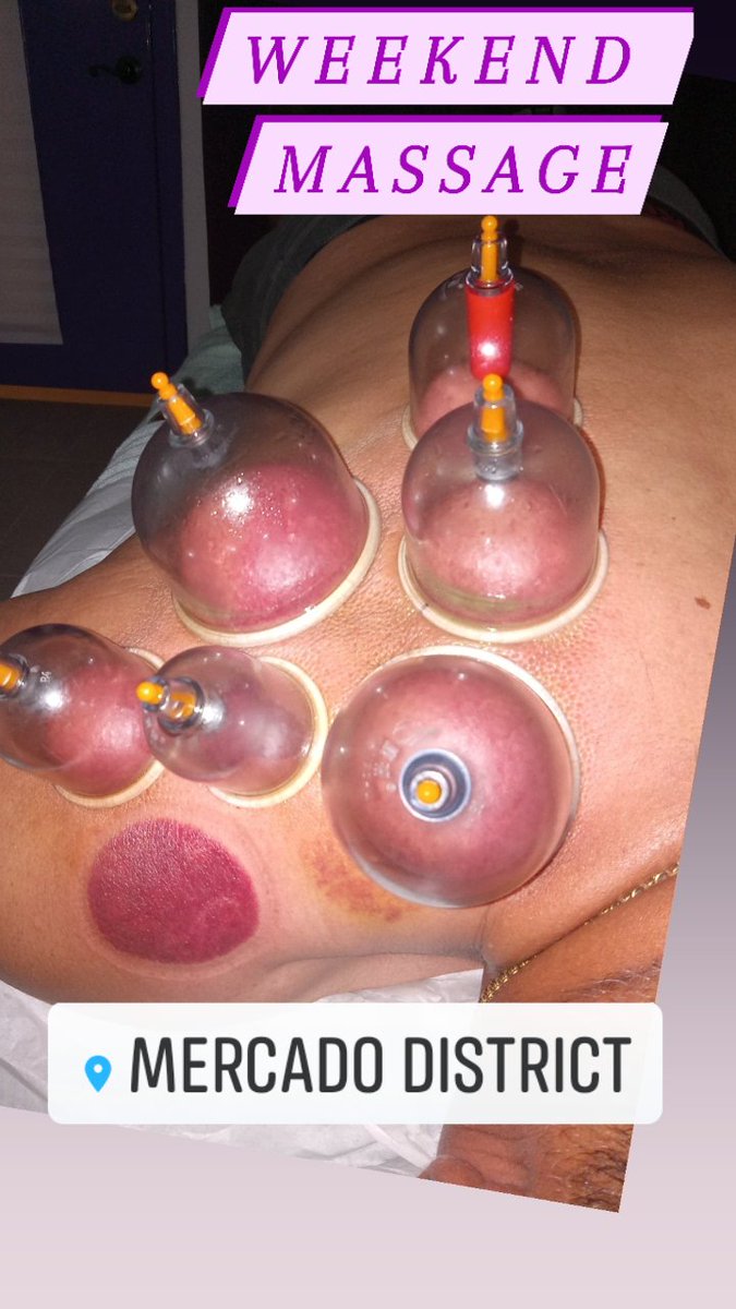 marinasmassages's tweet photo. #massagetherapy
#massagetime
#drinkwateraftermassage
#massageworld
#necktension
#cuppingtherapy
#deeptissuemassage
#LicensedMassageTherapist
#supportmassagetherapist
#mcallentexas78504
#rgv956
#marinagarzalmt
#marinagarzalmt956
#MARINASMASSAGES
#cuppingmassage https://t.co/A2BzE6Hm2Q