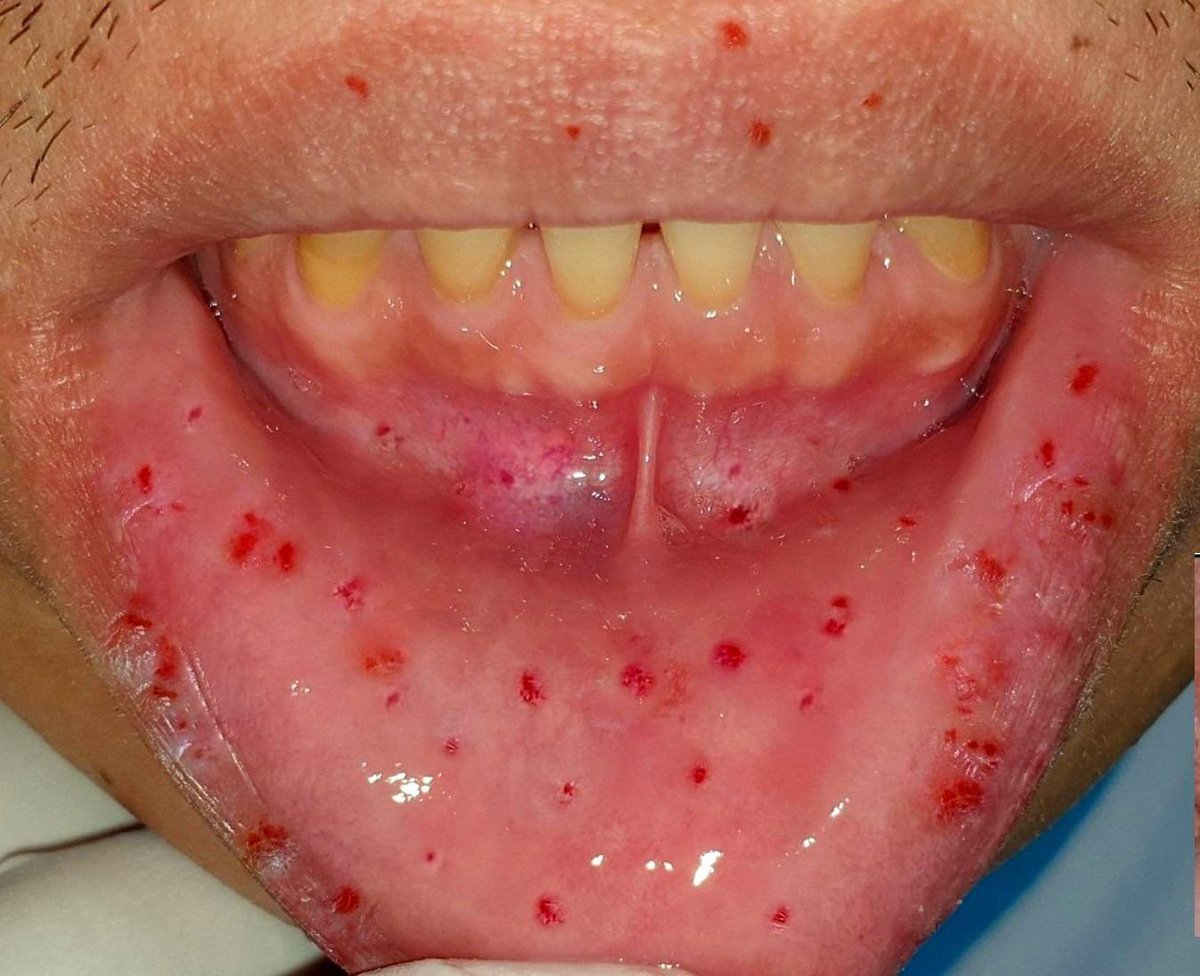 Keith Siau tweet media