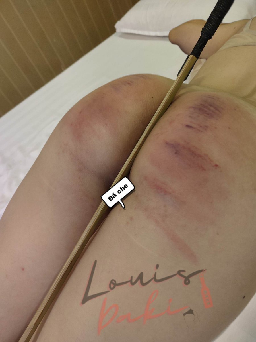 dakidaki1301's tweet photo. 🥺

#spanking #spank #sp #barebottom #bare_ass #caned https://t.co/2Efq1TGU60