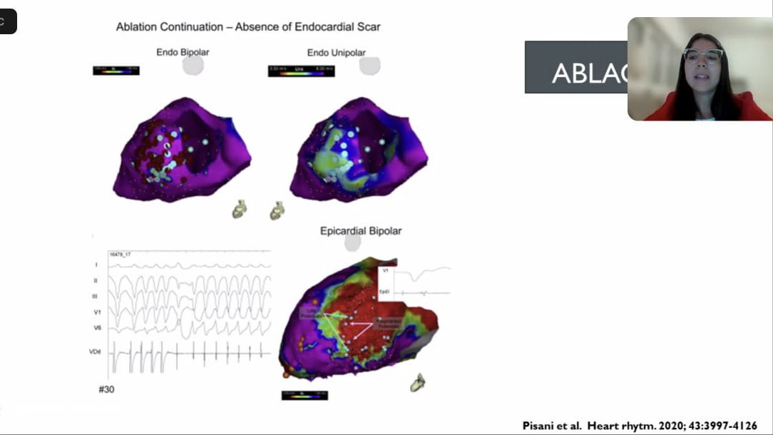 ArgerichCardio tweet picture