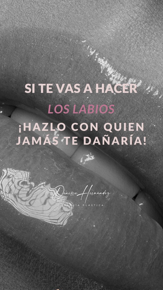 Dradenhdez's tweet photo. 💋#DiaDelBeso https://t.co/Xw98NgNQCu