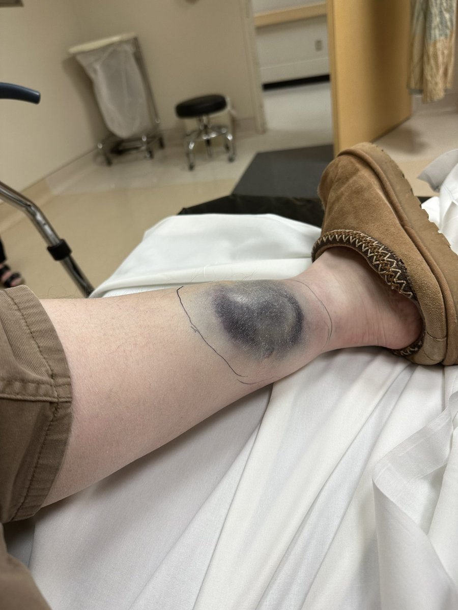 Chris Elkins tweet media