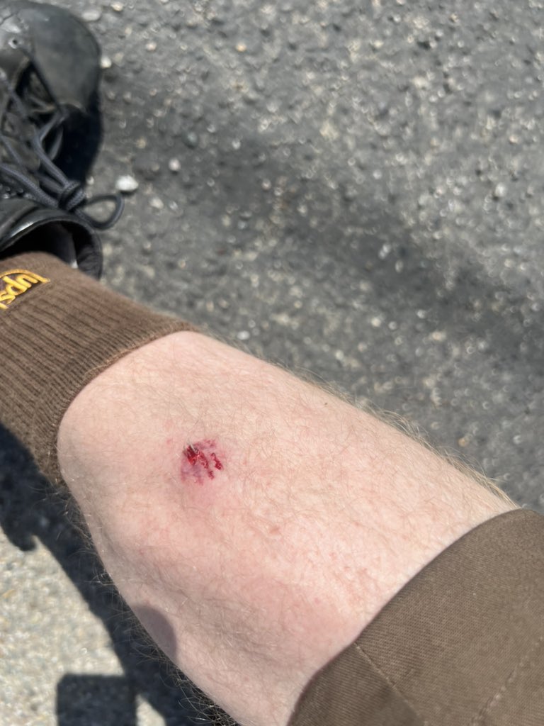ashsmash420's tweet photo. Shout out to the chihuahua that made me bleed my own blood https://t.co/13oj4Pb1kM