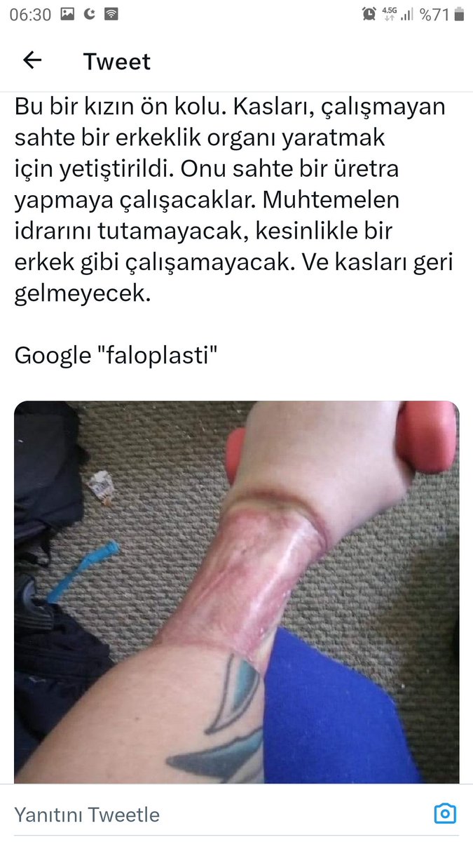 Abdurra32921102's tweet photo. @ProfSFindik Koldan pipi yapma ameliyatı,,, https://t.co/WXkEk5X2o3