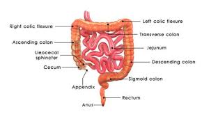 Appendicitis occurs when the appendix becomes inflamed and filled with pus. Appendicitis is an inflammation of the appendix, a finger-shaped pouch that projects from your colon on the lower right side of your abdomen. kindly visit more articles medical-case-reports.imedpub.com