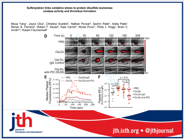 JTH (@jthjournal) on Twitter photo Protein Disulfide Isomerase (PDI) is cysteine sulfenylated to promote thrombus formation in oxidative stress.
<a href="/MouaYang21/">Moua Yang</a>
<a href="/HemeThrombBIDMC/">Hemostasis and Thrombosis, BIDMC</a>
<a href="/dr_joyce_chiu/">Joyce Chiu</a>
<a href="/CentenaryInst/">Centenary Institute</a>
<a href="/BrianC_Smith/">Brian Smith</a>
<a href="/briansmithlab/">Brian Smith Lab</a>
<a href="/LabPozzi/">Nicola Pozzi</a>
bit.ly/3KiYMfi Protein Disulfide Isomerase (PDI) is cysteine sulfenylated to promote thrombus formation in oxidative stress.
<a href="/MouaYang21/">Moua Yang</a>
<a href="/HemeThrombBIDMC/">Hemostasis and Thrombosis, BIDMC</a>
<a href="/dr_joyce_chiu/">Joyce Chiu</a>
<a href="/CentenaryInst/">Centenary Institute</a>
<a href="/BrianC_Smith/">Brian Smith</a>
<a href="/briansmithlab/">Brian Smith Lab</a>
<a href="/LabPozzi/">Nicola Pozzi</a>
bit.ly/3KiYMfi