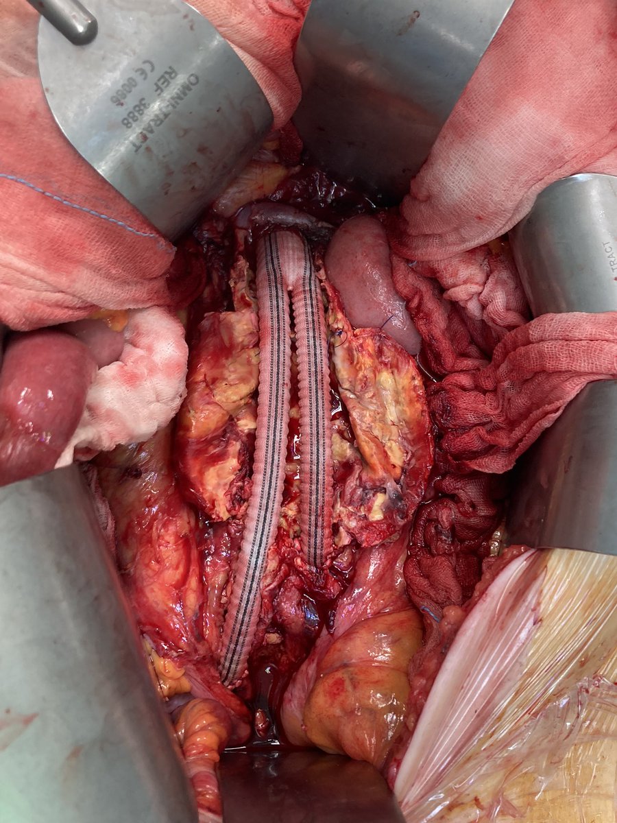 The #veterosurgery of the week. #aorta