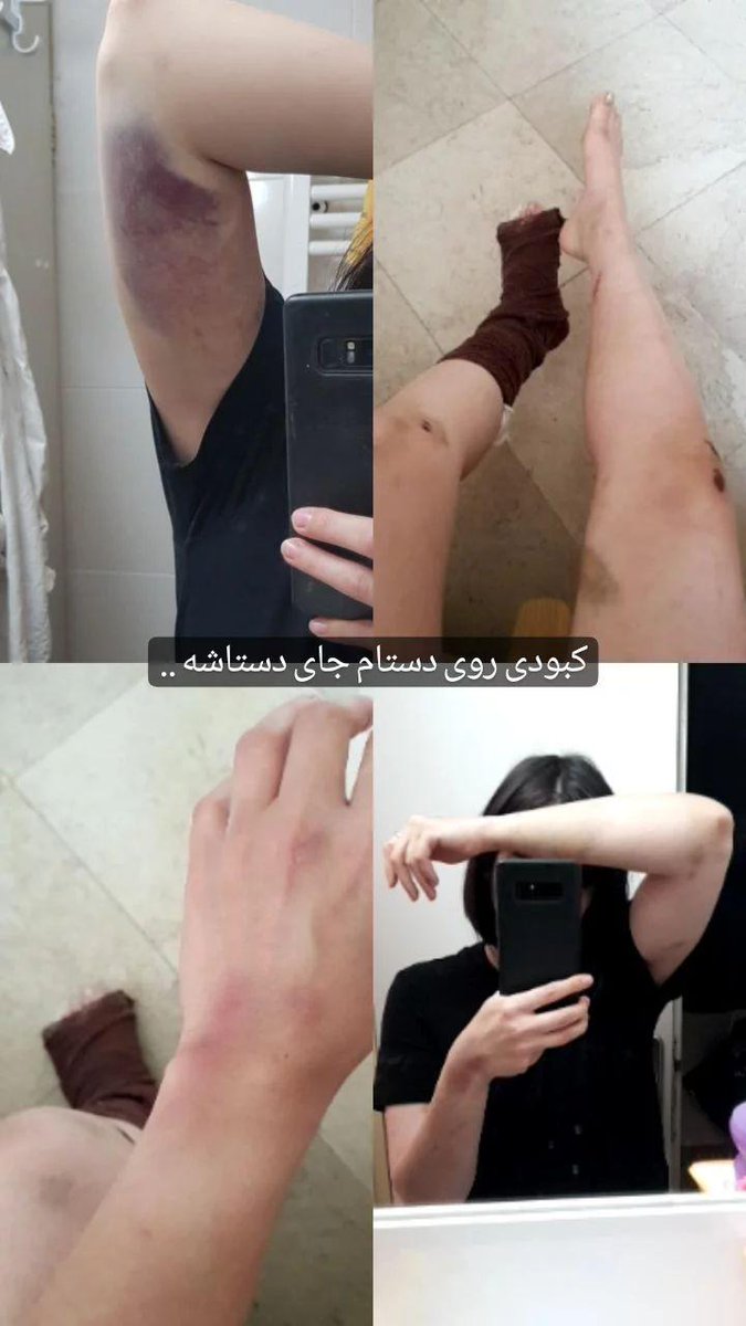 itwasblackbird's tweet photo. بچه‌ها ممنون میشم اگر توئیت قبلیم رو تا میتونین ریت کنین بلکه کسی پیدا شه کمکم کنه روند شکایت و پیدا کردنشون واسم سریعتر پیش بره.

بوس و قلب فراوان https://t.co/XdRdRJnQmI