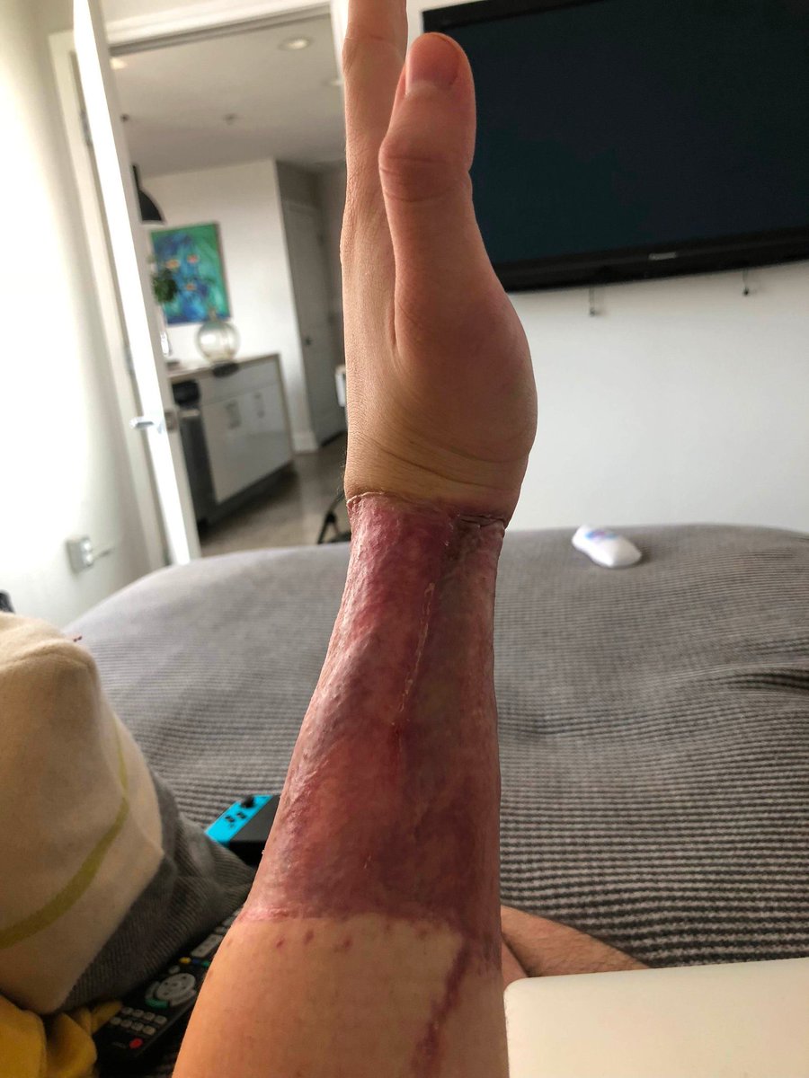 Jacksun0's tweet photo. @BlckFuzz @Richard__Forest @MrBeast @DiscussingFilm If you’re comfortable being in your own body, why would you take drugs to change your gender? Isn’t that quite literally opposite of being comfortable in your body? Also- this is a post fem surgery. https://t.co/90vRLPiQjP