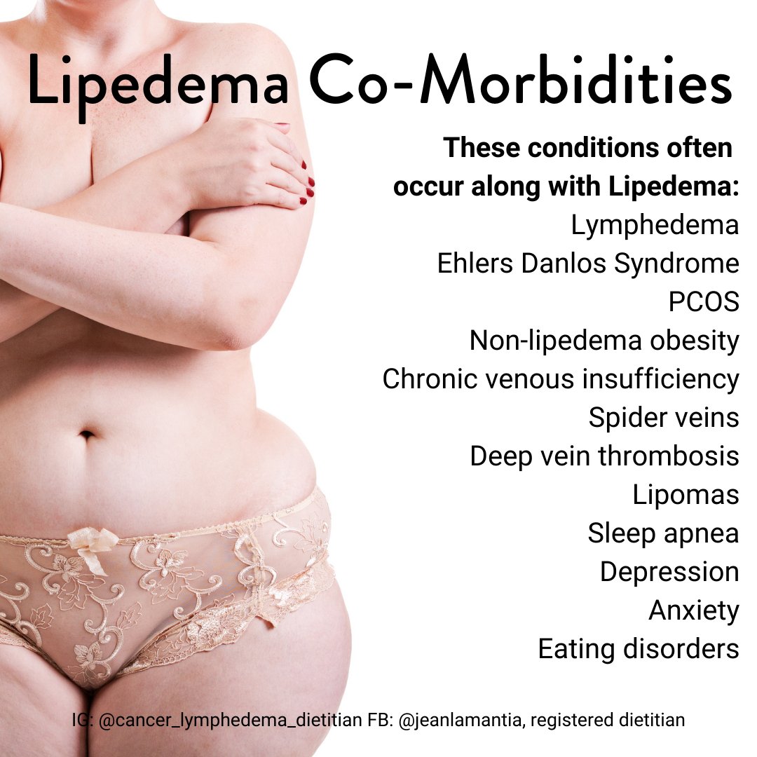 Jean LaMantia on X: These conditions often occur along with Lipedema:  Lymphedema, Ehlers Danlos Syndrome, PCOS, Chronic venous insufficiency and  more. #lipedema  / X