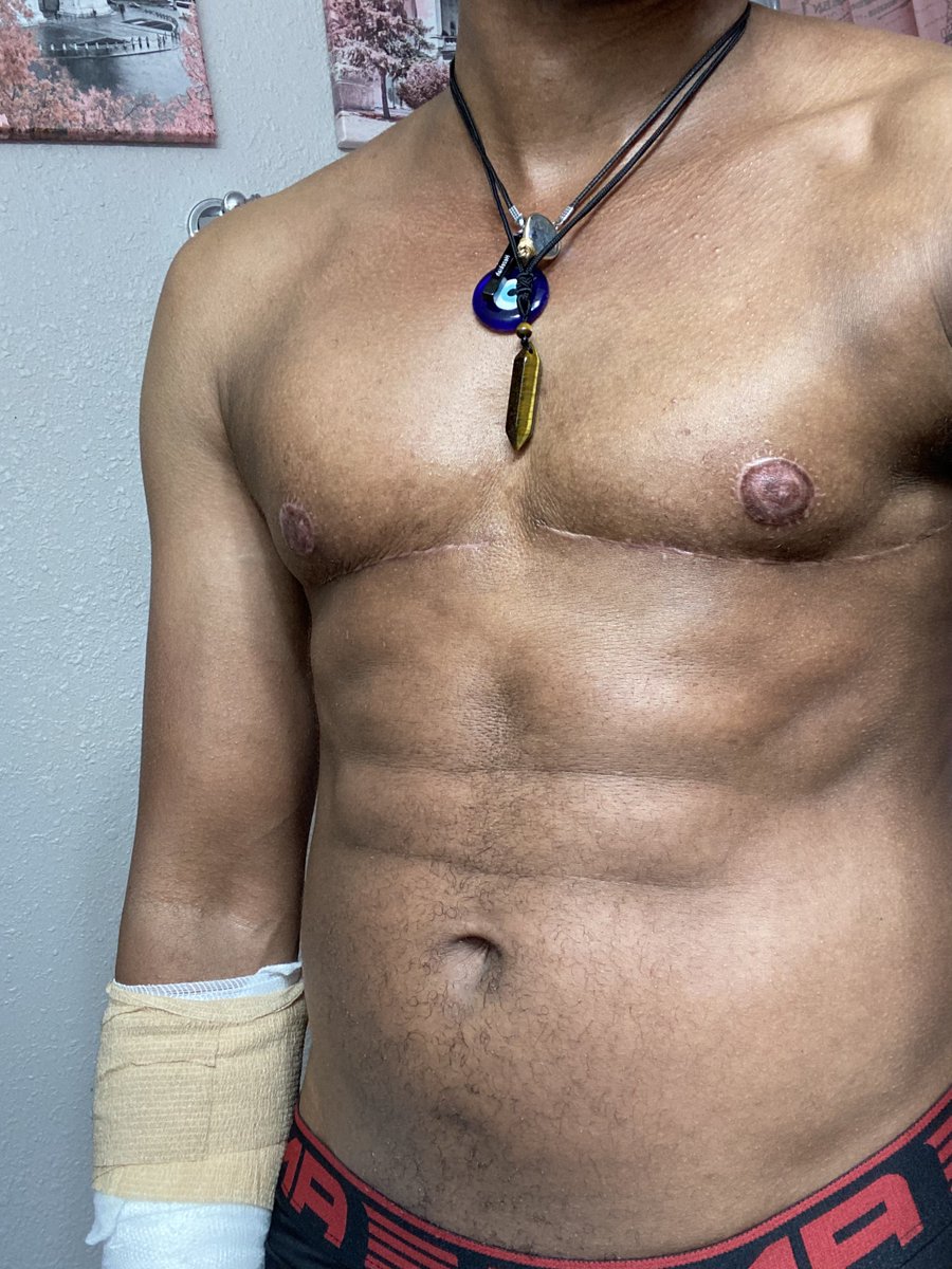 thorprototype's tweet photo. Trying to be one of your favorites #transman #transmanofcolor #shirtlesssummer #glowup #manifestinggreatness 🧿💫😘🌻🍆🖤 https://t.co/qhP7X02Cg3
