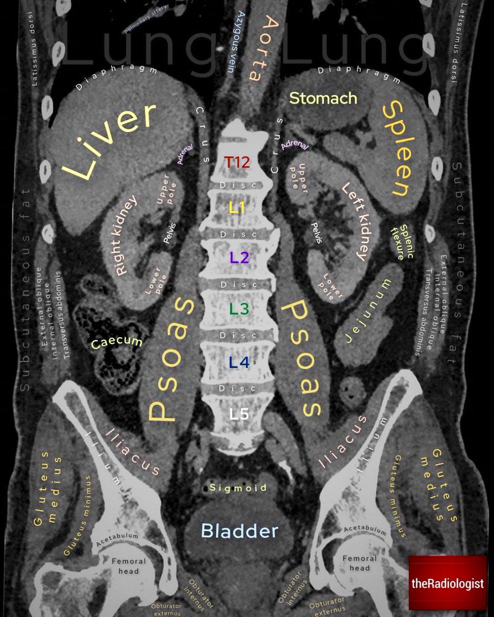 How to Read a CT Scan: Abdomen and Pelvis Anatomy 🩻
#radiology #radiography #FOAMrad #radres #radtwitter #MedTwitter #MedEd #INNOMed #FOAMed #FOAMcc 
H/T @radiologistpage