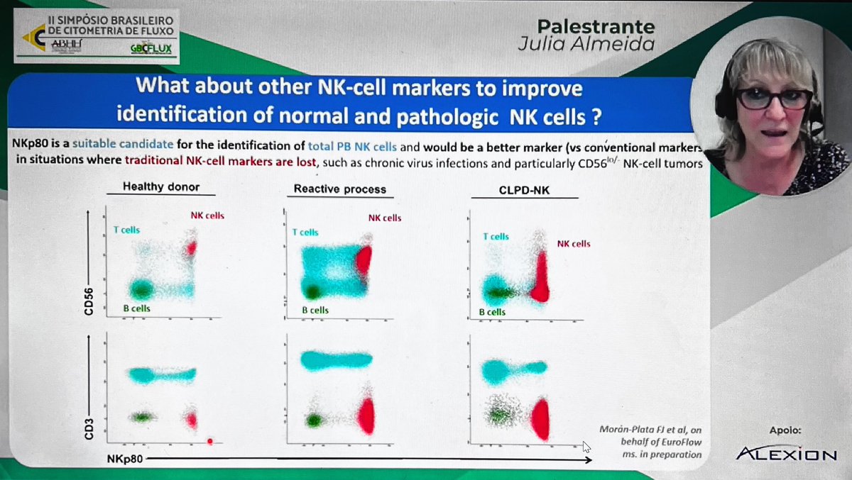 _priteixeira_'s tweet photo. Day 2 - Brazilian Simposium of #flowcytometry starting with Dr Julia Almeida and the diagnosis of T and NK lymphoproliferative neoplasms. 
Rare and serious conditions still with difficult diagnosis 
#gbcflux2023 @abhhoficial 
#lymphomas https://t.co/LlejBdMgbO